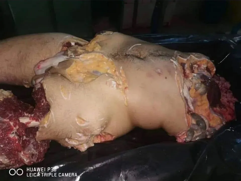 Alledged remains of Russian attacked by shark in June in Egypt.webp