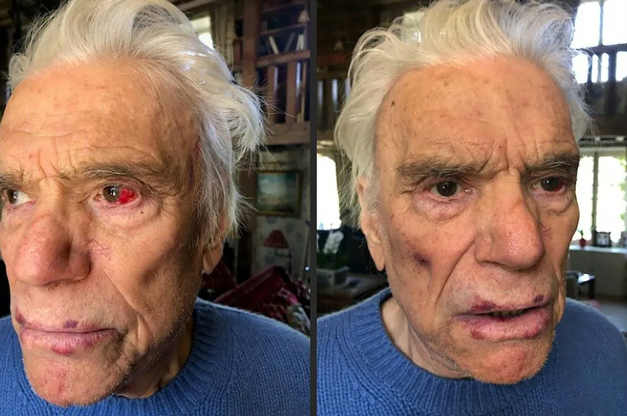 bernard-tapie-assaulted-03.webp