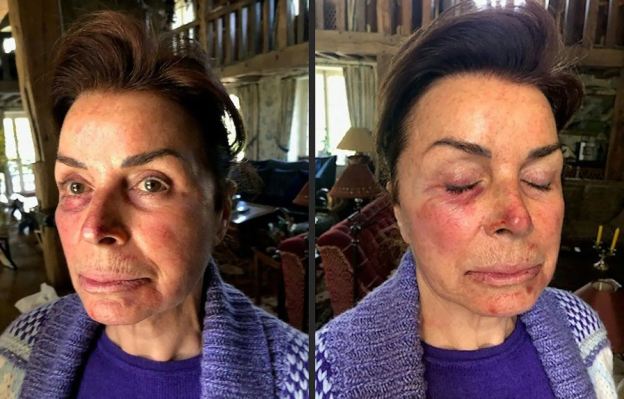 bernard-tapie-assaulted-04.webp