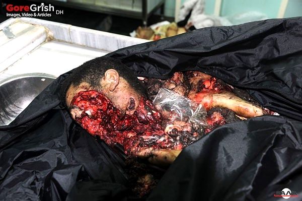 bombing-victim1-Damascus-Syria-20120106.jpg