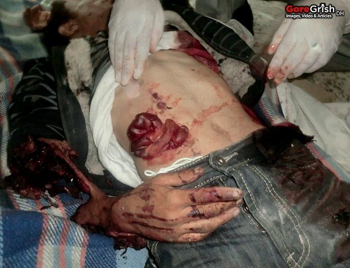 bombing-victim1-Yemen-may-11.jpg