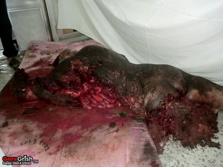 bombing-victim1-Yemen-may25-11.jpg