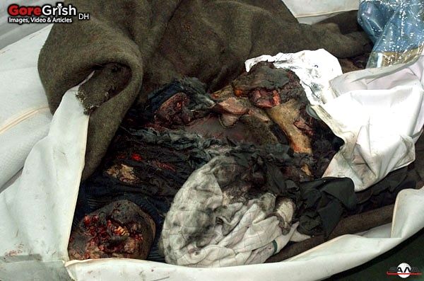 bombing-victim2-Damascus-Syria-dec23-11.jpg