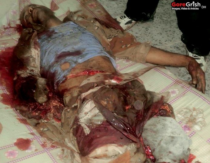 bombing-victim2-Yemen-may-11.jpg