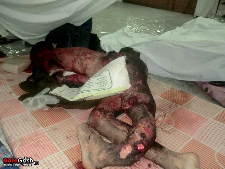 bombing-victim2-Yemen-may24-11.jpg