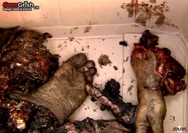 bombing-victim3-Damascus-Syria-dec23-11.jpg