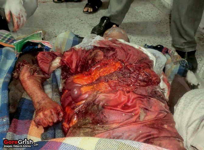 'bombing-victim3-Yemen-may-11.jpg
