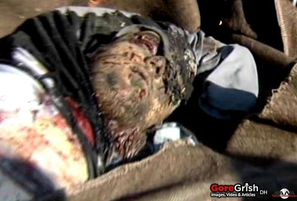 bombing-victim4-Damascus-Syria-dec23-11.jpg