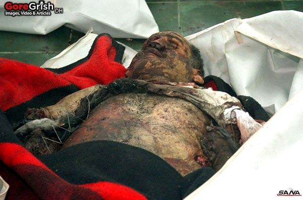 bombing-victim6-Damascus-Syria-dec23-11.jpg