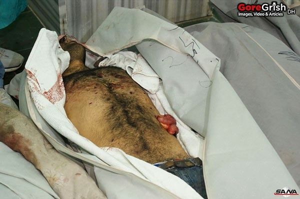 bombing-victim7-Damascus-Syria-dec23-11.jpg