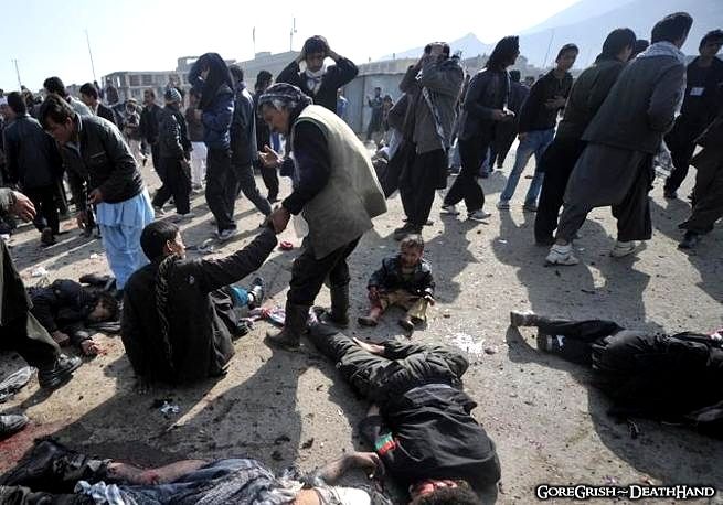 dead-and-injured-after-suicide-bomb-blast3-Kabul-dec6-11.jpg
