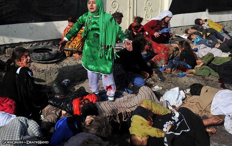 dead-and-injured-after-suicide-bomb-blast6-Kabul-dec6-11.jpg