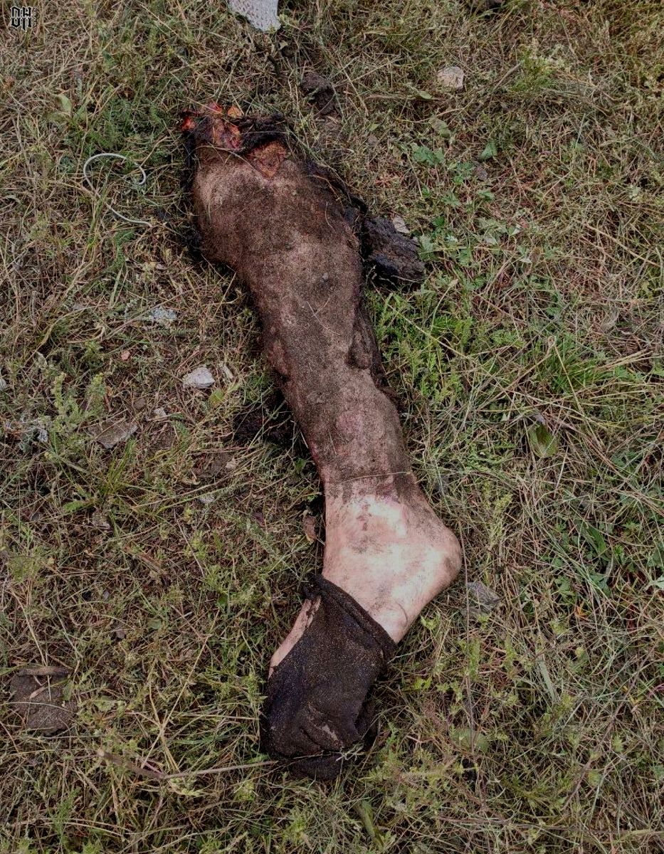 DH - Sldiers' Horror Faces and Bodies of Russia-Ukraine Conflict 17.jpg