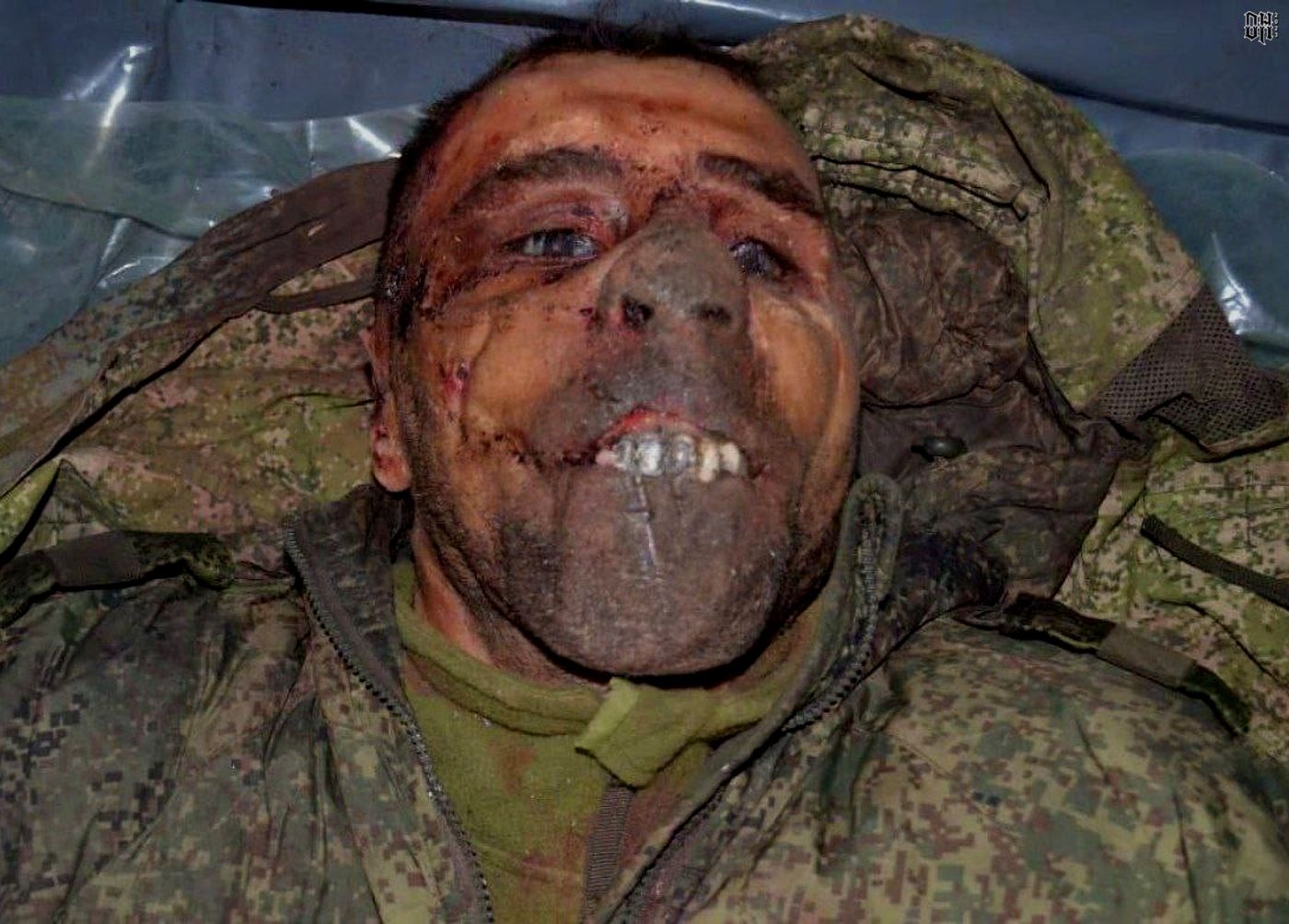 DH - Sldiers' Horror Faces and Bodies of Russia-Ukraine Conflict 23.jpg