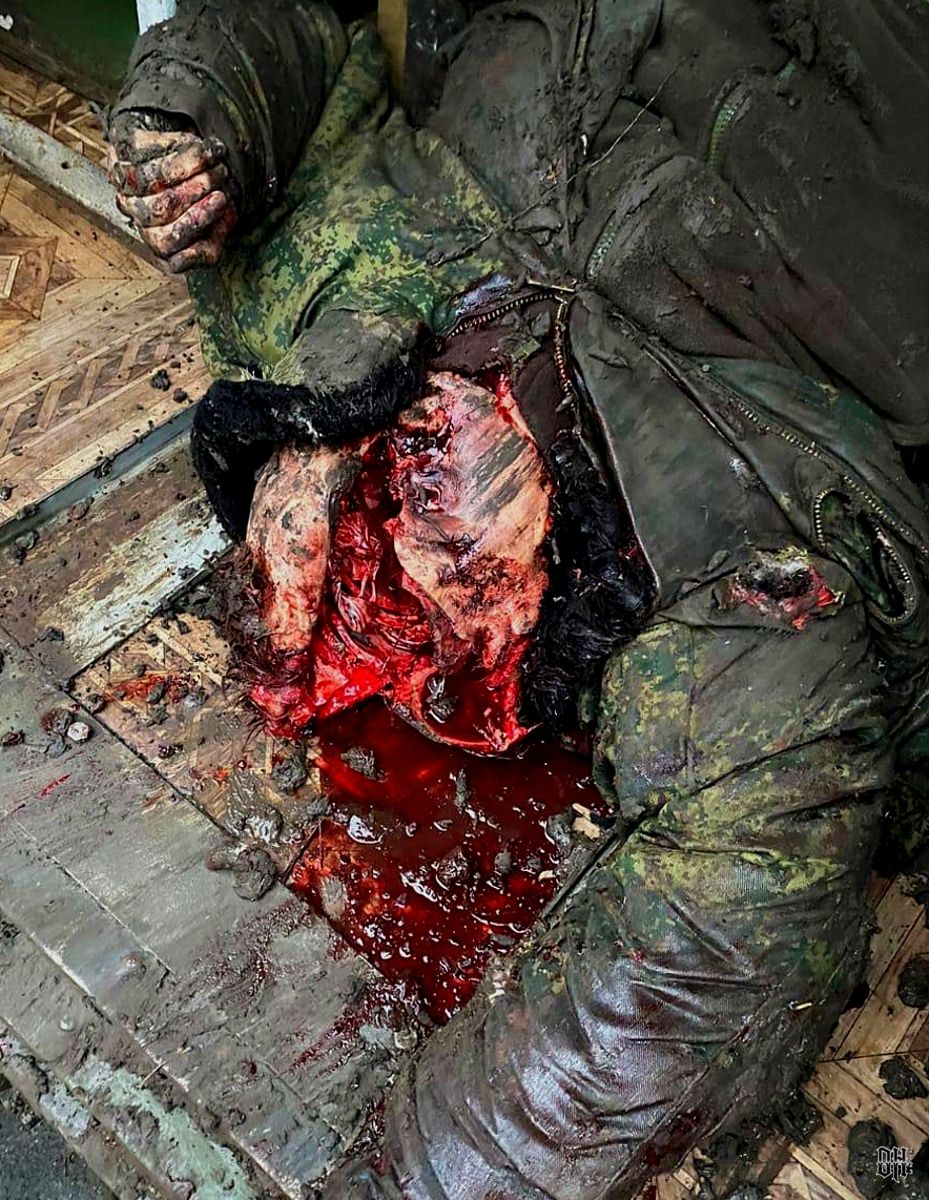 DH - Sldiers' Horror Faces and Bodies of Russia-Ukraine Conflict 33.jpg