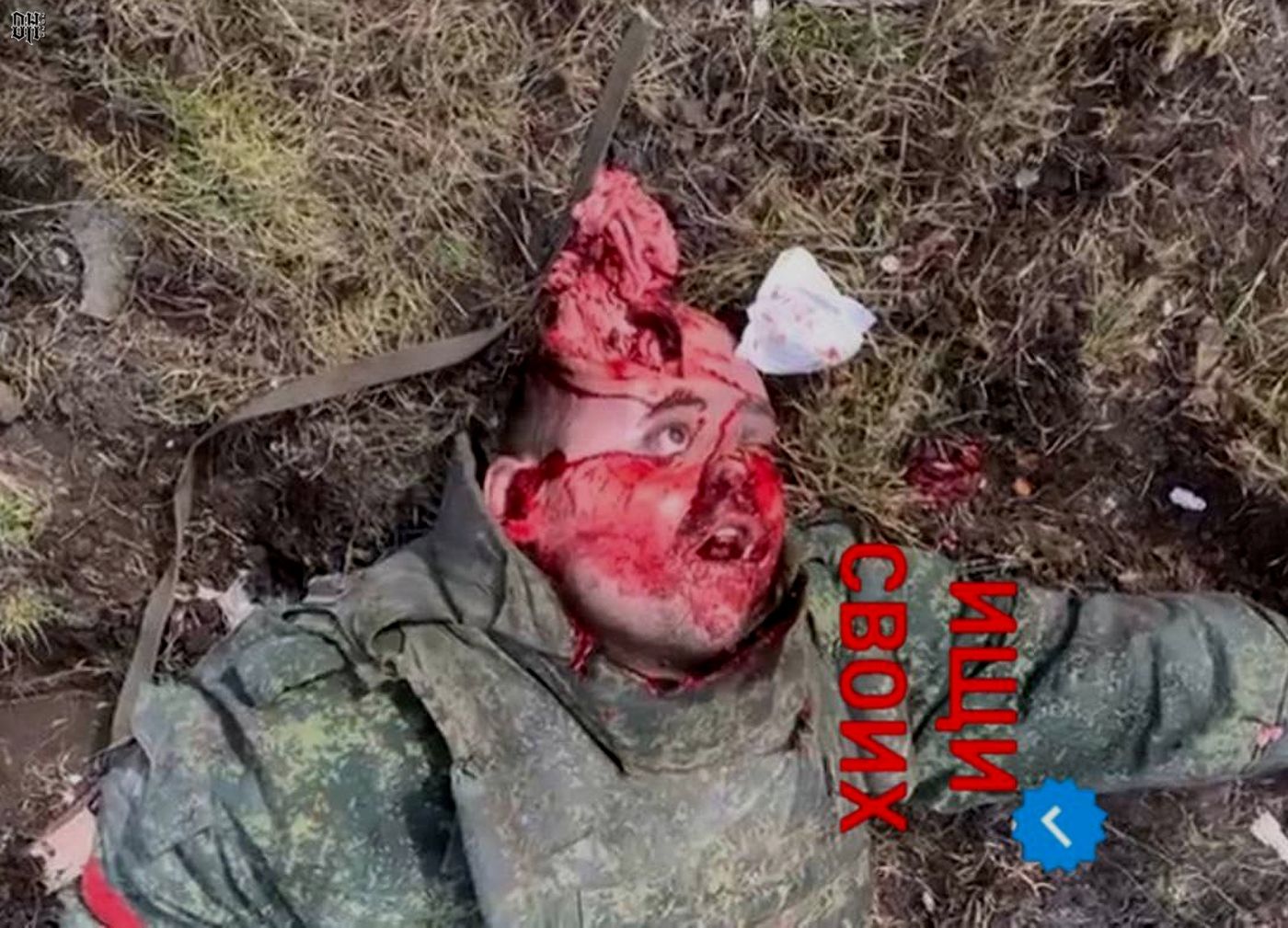 DH - Sldiers' Horror Faces and Bodies of Russia-Ukraine Conflict 38.jpg
