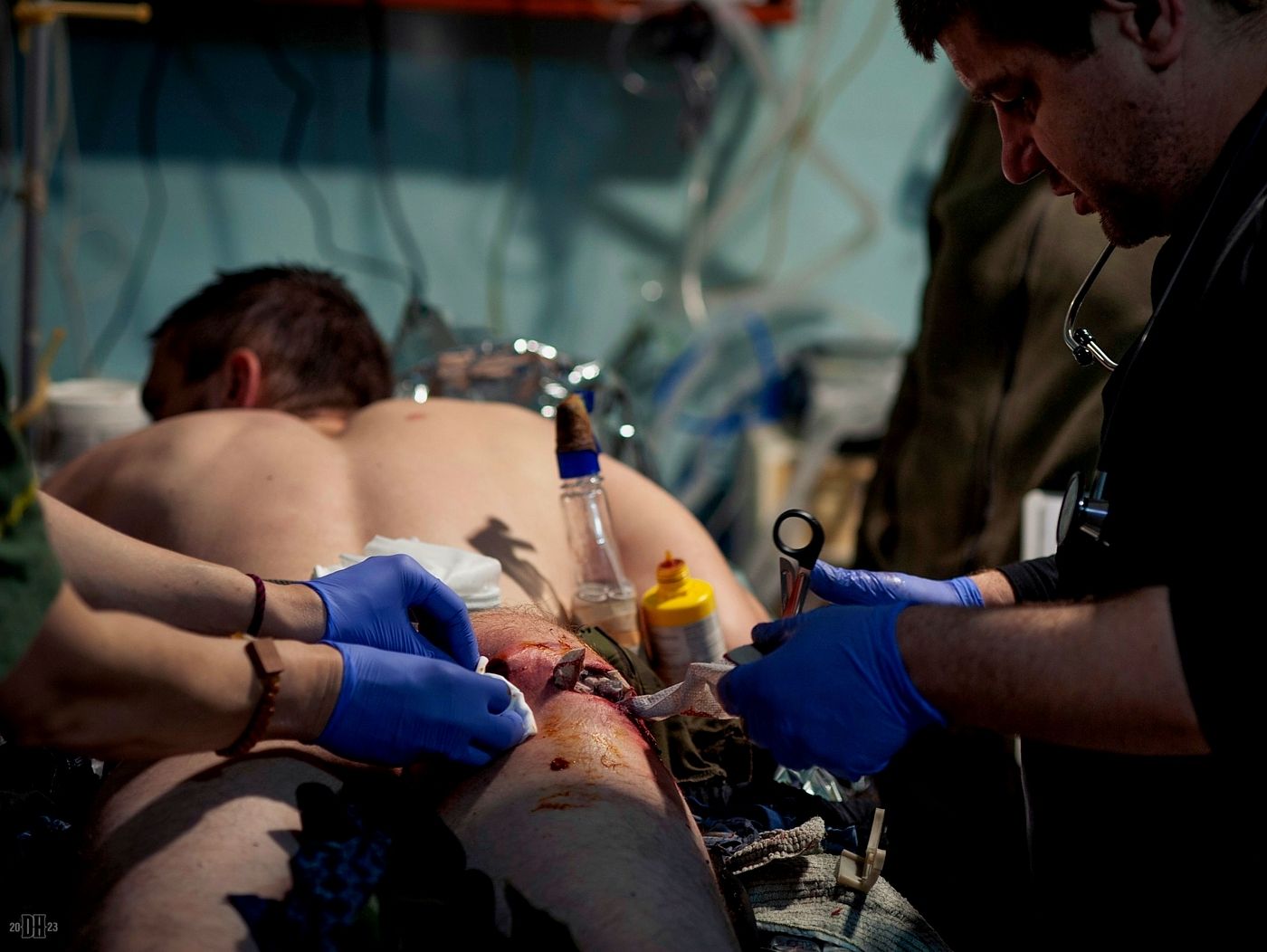 DH - Wounded Ukrainian 93rd Brigade soldier at a mobile hosp 3 - Dombas - Apr 2023.jpg