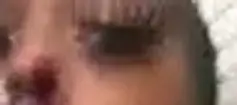 eye.webp