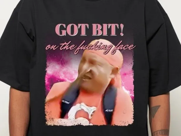 face bite.webp