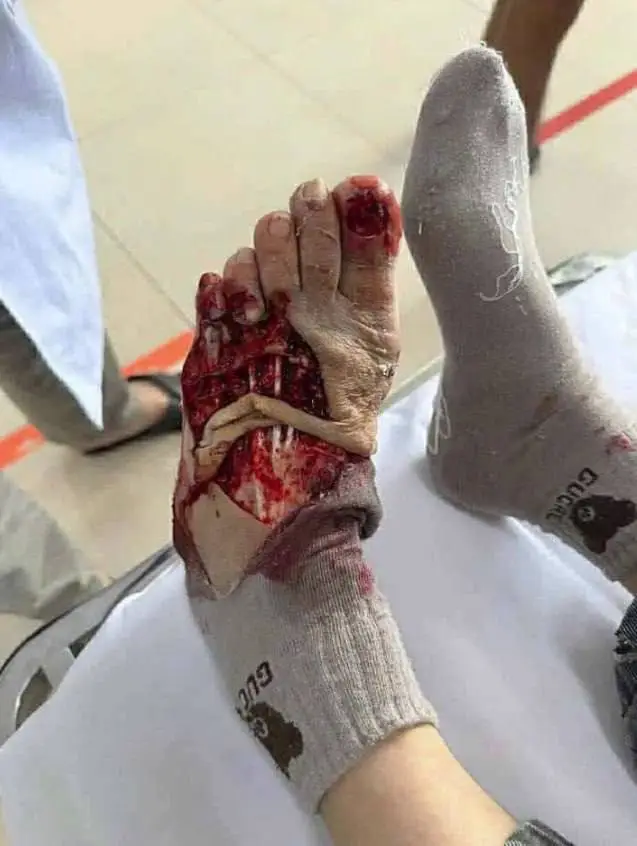 foot.webp