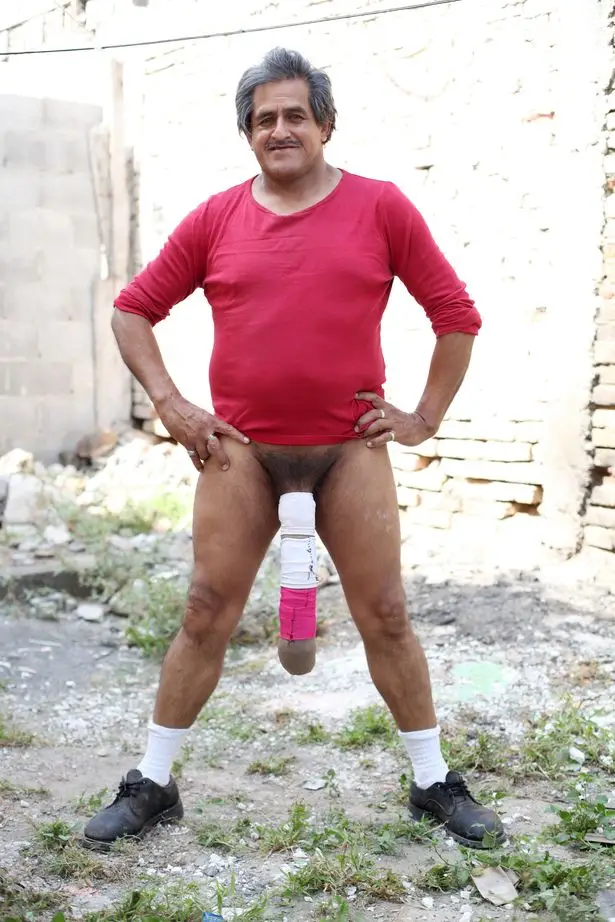 Half-Metre-Member-Man-With-The-Worlds-Biggest-Penis-Refuses-A-Reduction.webp