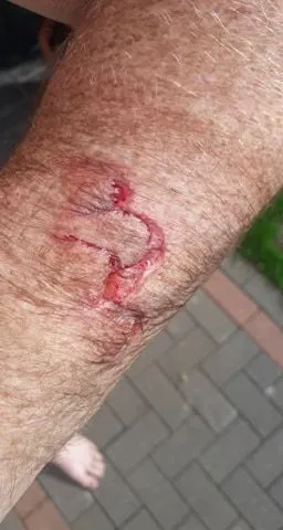 i had a boo boo.....webp