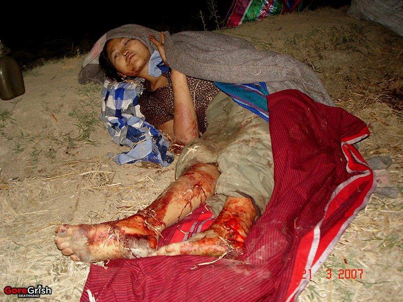 injured-by-spdc-mortar1-Toungoo-Burma-mar21-07.jpg