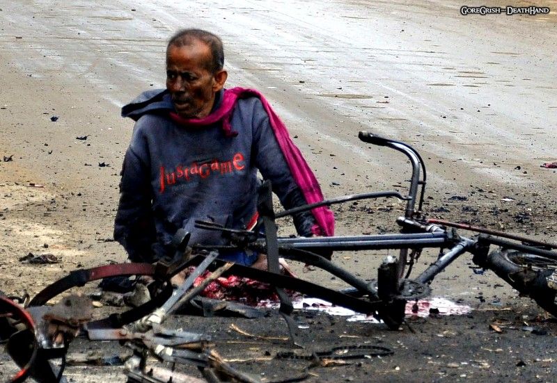injured-man-after-bomb-attack1-Imphal-India-nov30-11.jpg