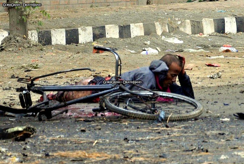injured-man-after-bomb-attack2-Imphal-India-nov30-11.jpg
