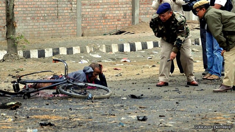 injured-man-after-bomb-attack3-Imphal-India-nov30-11.jpg