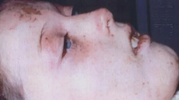 Jennifer Schuett after her rescue.webp