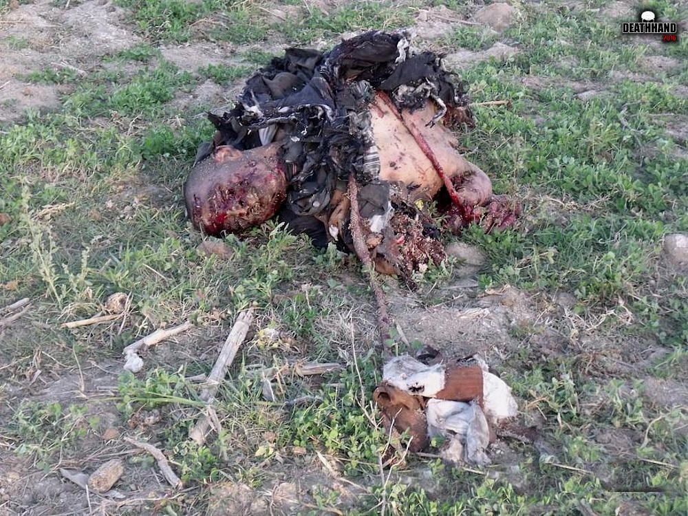 land-mine-destroys-man-7-Afghanistan-2012.jpg