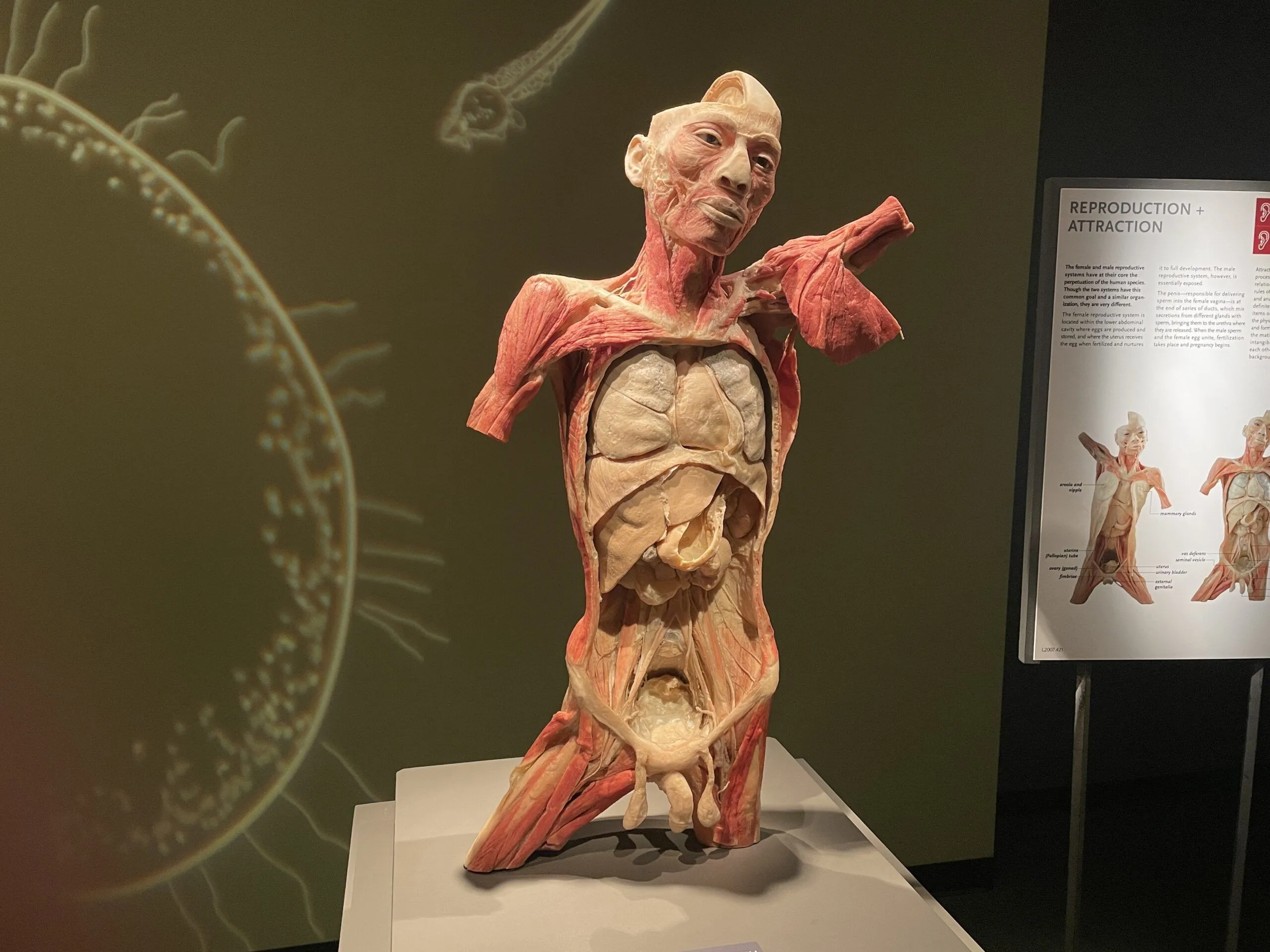 Partial-Body-Specimen-at-Bodies-scaled.webp