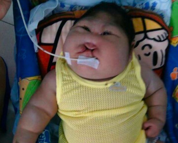 PAY-HEARTBREAKING-pictures-show-deformed-baby-that-needs-help.jpg