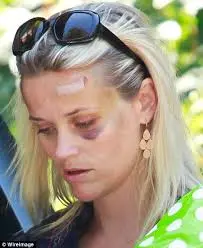 Reese shiner.webp
