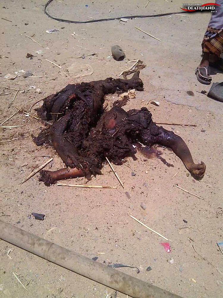 refugee-camp-hit-during-saudi-airstrike-12-Harad-District-YE-apr-1-15.jpg