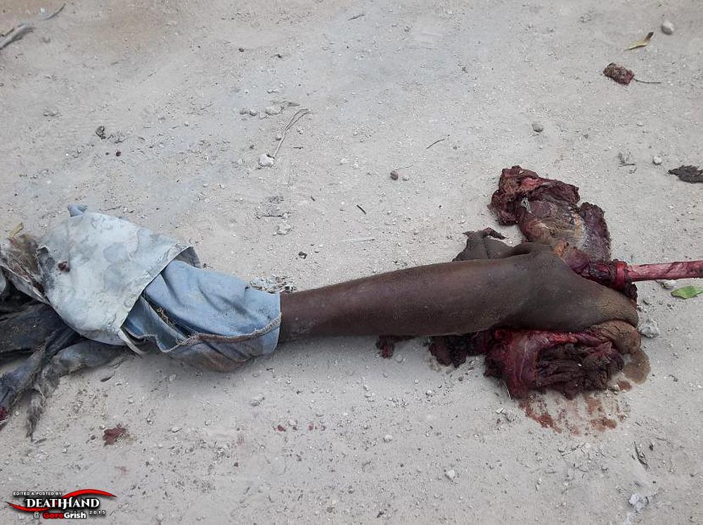 remains-of-two-male-suicide-bombers-5-Mogadishu-SO-aug-1-12.jpg