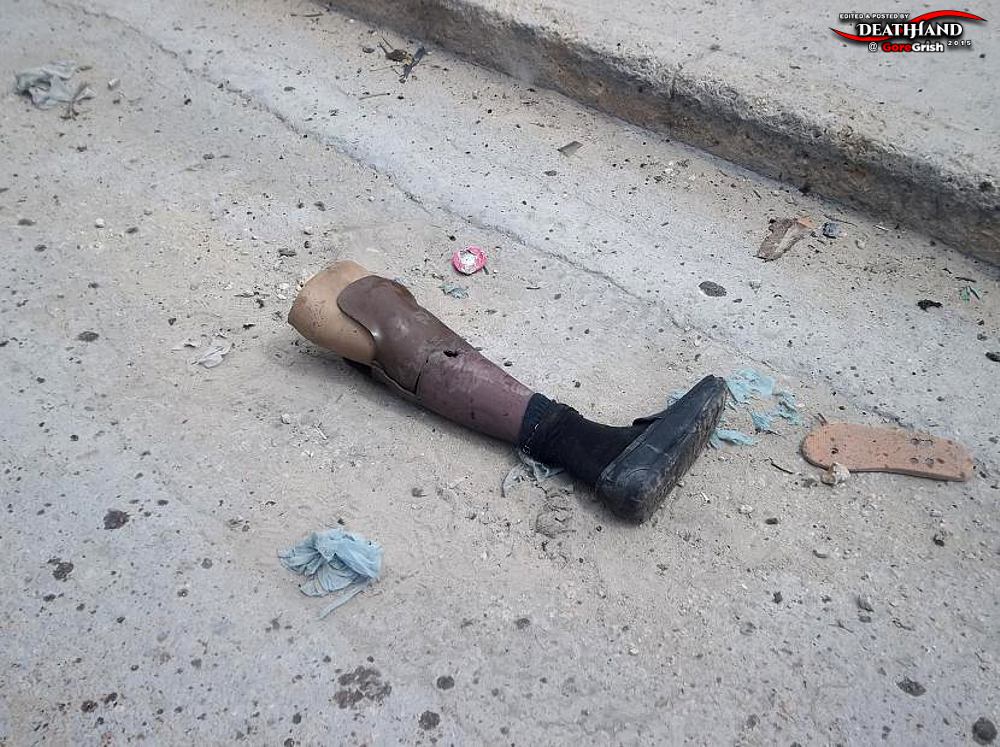 remains-of-two-male-suicide-bombers-6-Mogadishu-SO-aug-1-12.jpg