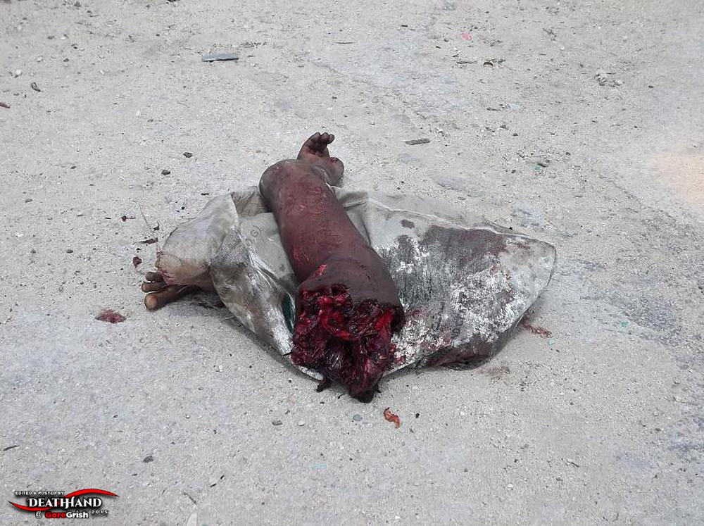 remains-of-two-male-suicide-bombers-7-Mogadishu-SO-aug-1-12.jpg