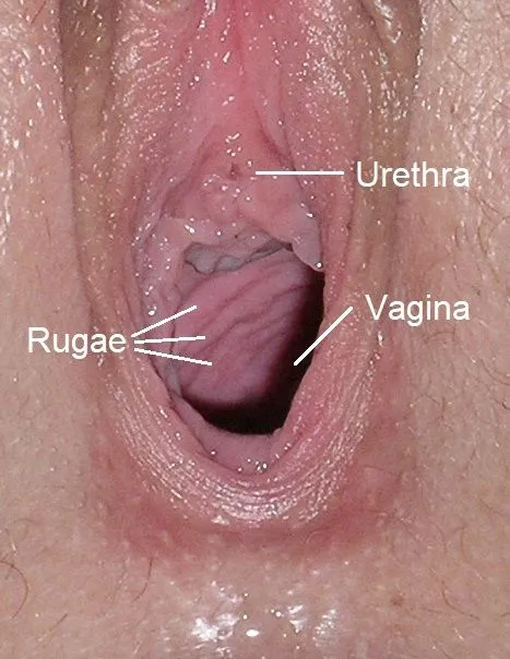 Rugae_vaginales.webp