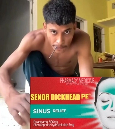sinus1.webp