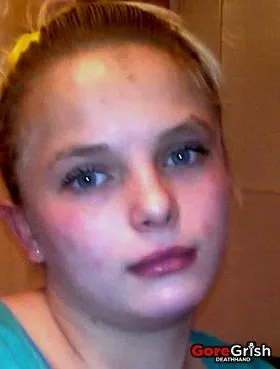teen-18-gangraped-burned1-Mykolayiv-Ukraine-mar16-12.webp