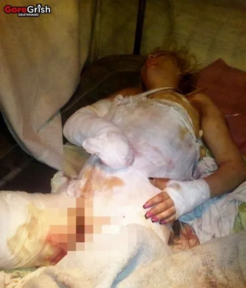 teen-18-gangraped-burned3-Mykolayiv-Ukraine-mar16-12.webp