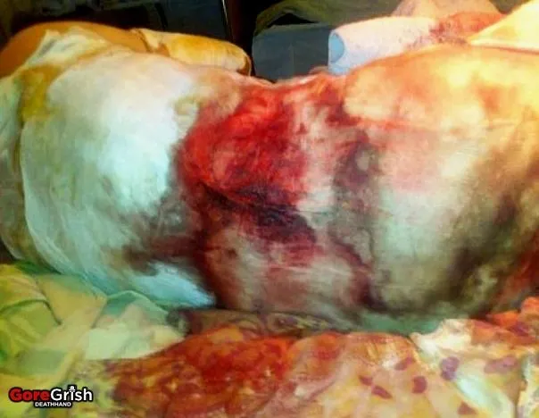 teen-18-gangraped-burned4-Mykolayiv-Ukraine-mar16-12.webp
