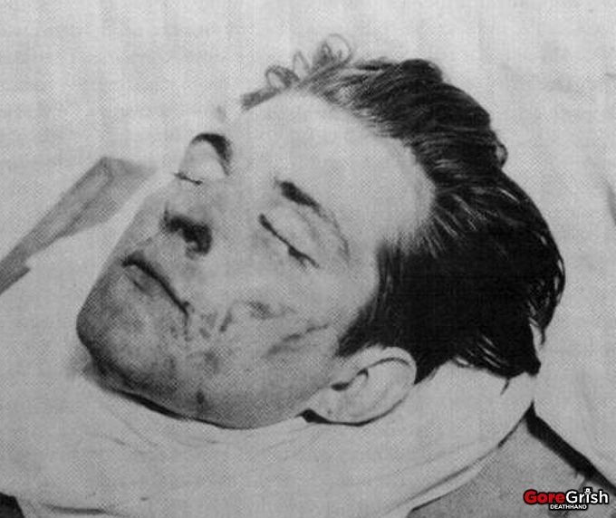 torso-murders4-victim4-head-Cleveland-OH-1934-38.jpg