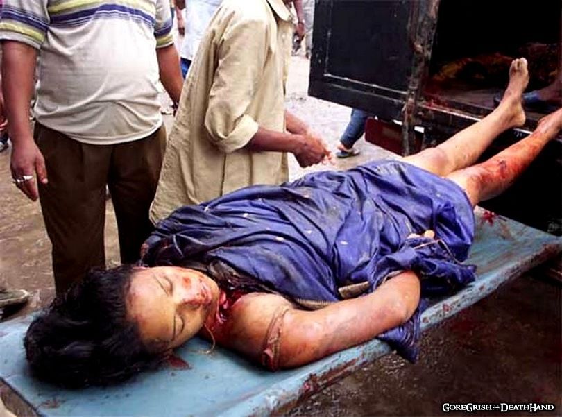 victims-of-bomb-blast1-Guwahati-Assam-India-aug15-04.jpg