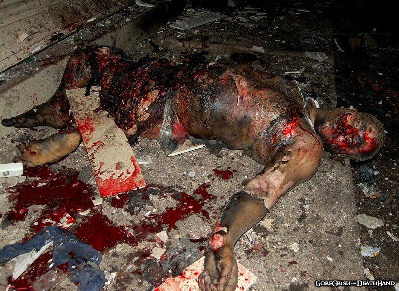 victims-of-bomb-blast1-Guwahati-Assam-India-nov5-06.jpg