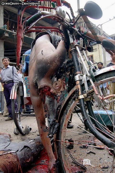 victims-of-bomb-blast2a-Guwahati-Assam-India-may26-07.jpg