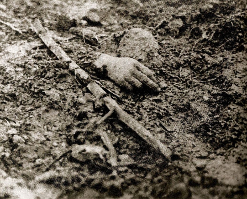 World War I Great One WWI severed hand battlefield mud.jpg