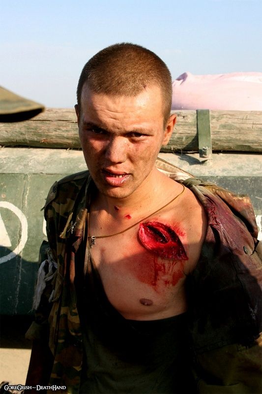 wounded-russian-soldier-aug2008.jpg